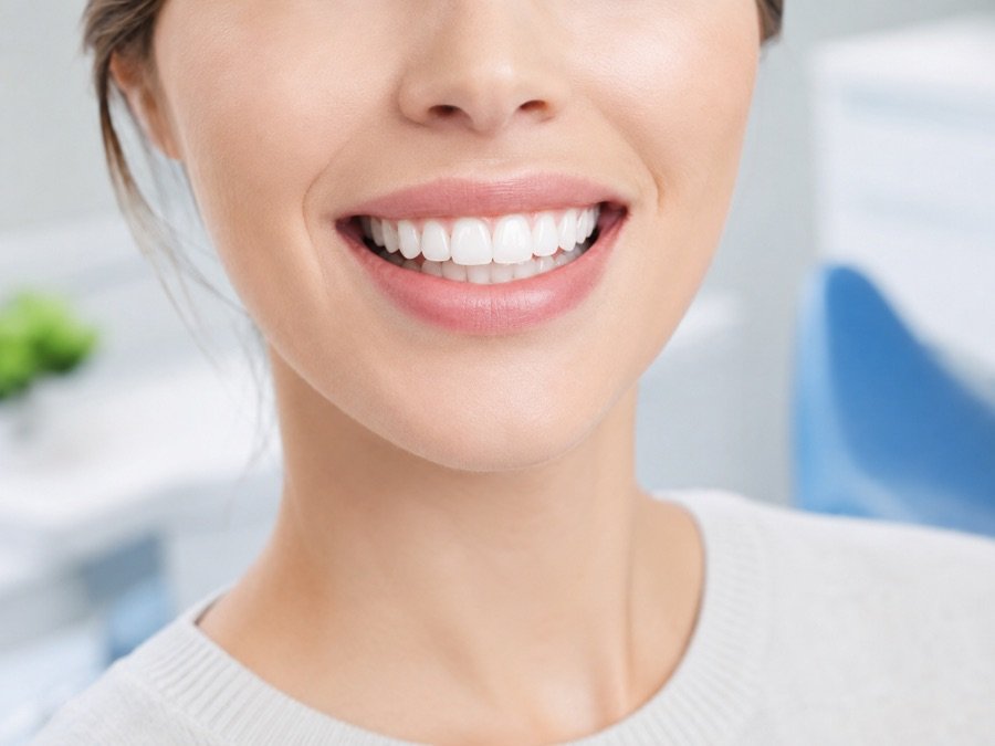Blanqueamiento dental
